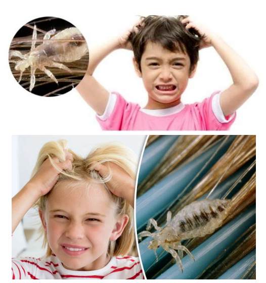 مشط إزالة القمل الكهربائي