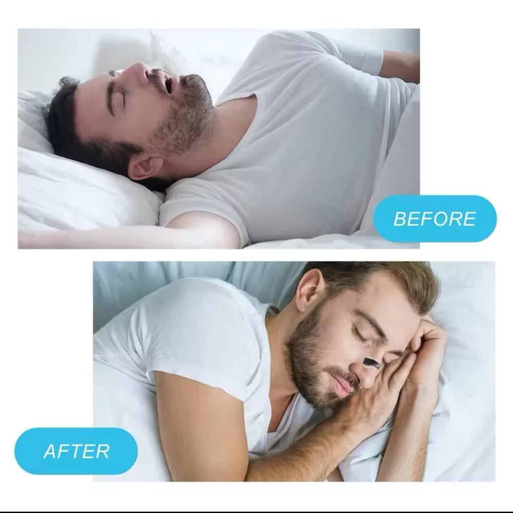 شرائط موسع الأنف مغناطيسية